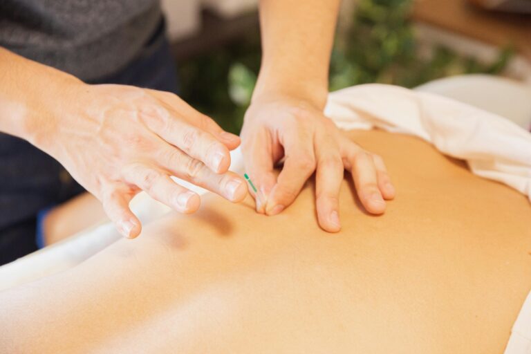 Why Acupuncture Is One of Greenville SC’s Best Kept Wellness Secrets